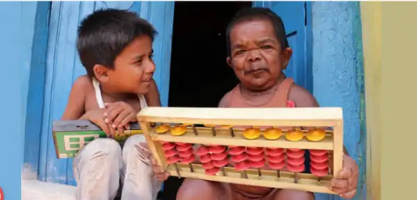 Meet The 50-Year-Old Man Who Stopped Growing At Age 5 (Photos)